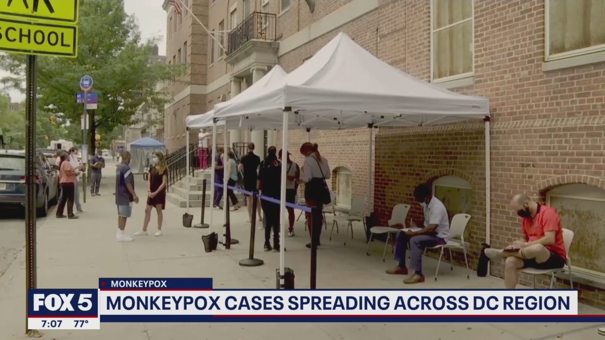 Monkeypox spreading among DC's homeless population